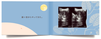 エコー写真アルバム（10ツキ10カものがたり）